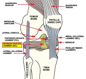 Anterior Cruciate Ligament (ACL) & Medial Collateral Knee Ligament (MCL)  Injuries