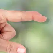 Mallet Finger